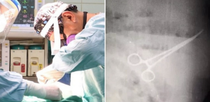 Chirurgo distratto dimentica forbici nella pancia del malato che muore