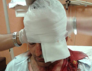 Autista ANM ferito a Fuorigrotta, spunta un video dell'aggressione [VIDEO]