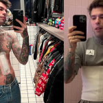 fedez cicatrice