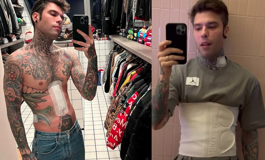 fedez cicatrice