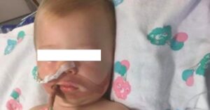 In coma a 10 mesi per aver ingoiato detersivo, bimba è grave: "Stomaco bruciato"