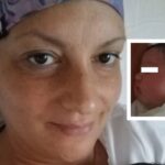 Miracolo della vita al Pascale, è nata Aurora: la gravidanza della madre con il cancro