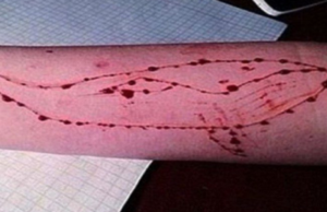Tentato suicidio in Campania, presunto caso di Blu Whale