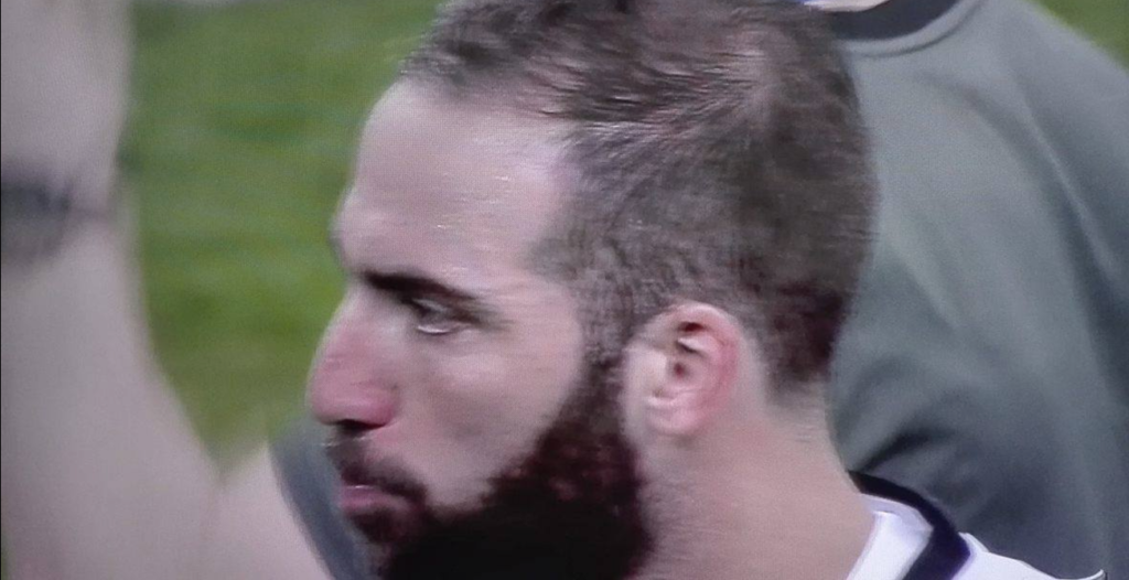 Juventus - Real Madrid, Higuain piange e Napoli esplode di gioia