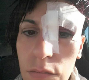 Salerno, arriva la denuncia di una cittadina: "Aggredita da un topo di fogna"