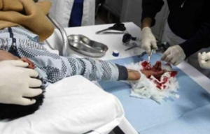 Pianura, prima vittima dei botti: persona ricoverata a causa di una mano devastata