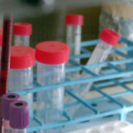 Coronavirus in Campania, il bollettino: altri 20 tamponi positivi