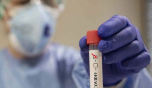 Covid19 in Campania, il bollettino