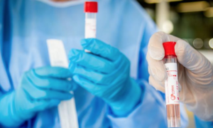 Coronavirus, il bollettino in Campania: 4 positivi, calano i tamponi analizzati