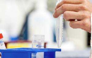 Covid in Italia, calano i contagi: oggi 1458 casi positivi e 7 decessi