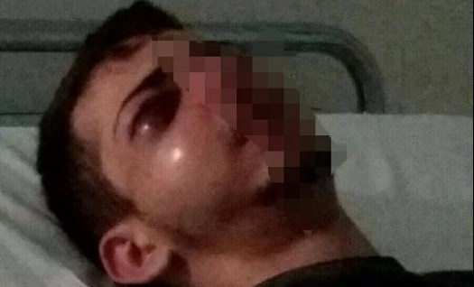 Pestaggio alla stazione di Pompei, identificati due aggressori