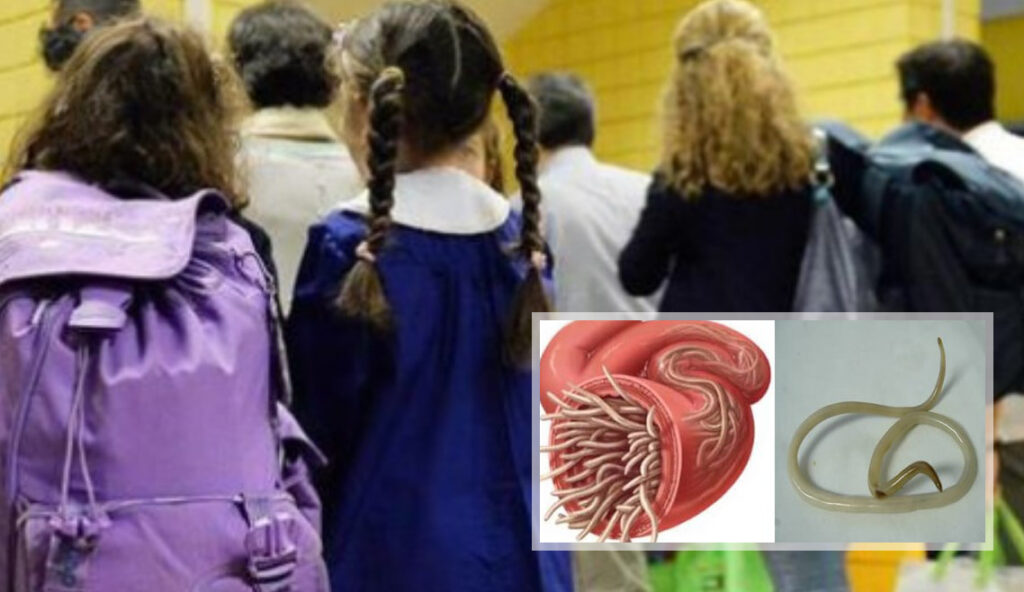 Allarme vermi nelle scuole del Napoletano, le denunce delle madri