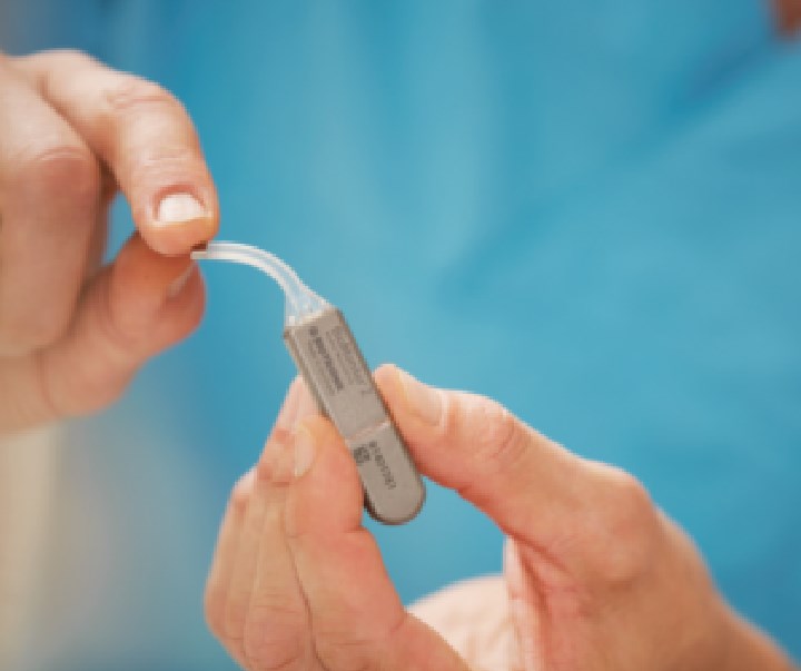 Santobono, bimba di 12 anni salvata grazie ad un innovativo micromonitor cardiaco