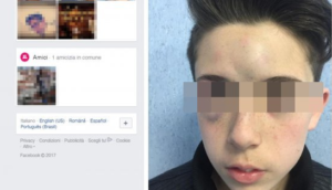 Aggredito da bulli, genitori 13enne postano foto choc su Facebook: "Denunciate questo schifo"