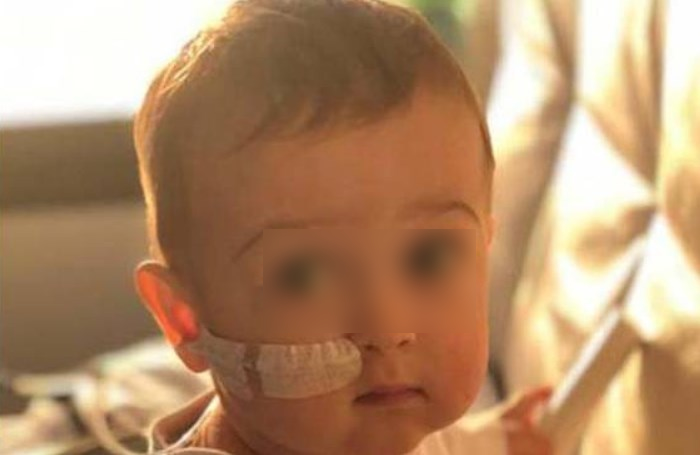 Il piccolo Alex sta bene, dopo l'intervento sono cresciuti anche i capelli