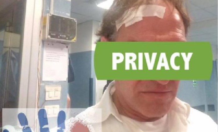 Ambulanza dell'Ascalesi, autista colpito al volto da una sedia