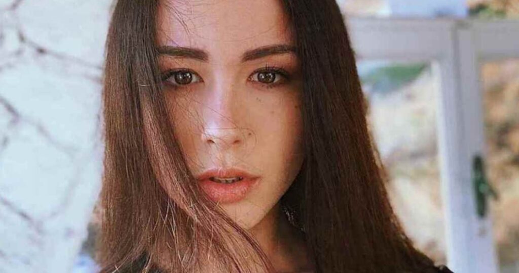 Aurora Ramazzotti dopo la foto con le imperfezioni confessa: "E' stato un vaffa"