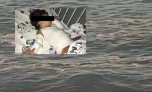 Lucrino, fa il bagno a mare: bimba di 13 mesi colpita da un'infezione