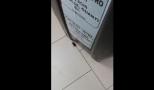 Blatte nel reparto Chirurgia dell'ospedale Loreto Mare: il video scandalo