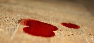 Casoria, guarda la ragazza sbagliata, ragazzo gambizzato