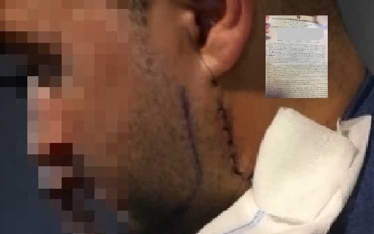 "Vuoi fare a pugni con me?", lo colpisce e gli rompe la mandibola: follia a Napoli