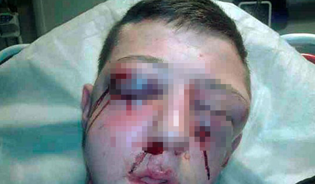 Giovane sequestrato e pestato per una rapina: la polizia arresta i responsabili