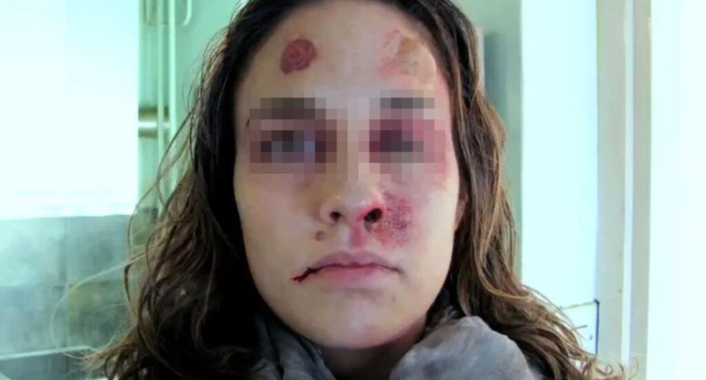 Napoli, violenta rapina in una tabaccheria di Bacoli: ferita una donna