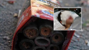 Ottaviano, bambino ferito al volto a causa di un petardo