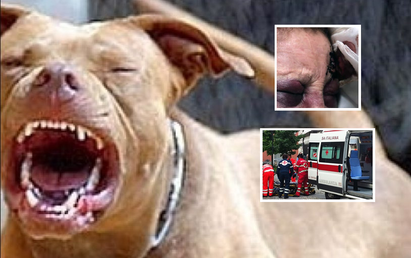 Litorale Domitio, anziana aggredita dai pitbull: è grave