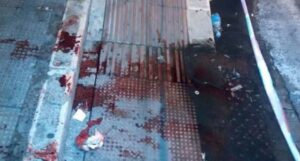 Sangue a Napoli: 22enne accoltellato si trascina in ospedale, è in coma