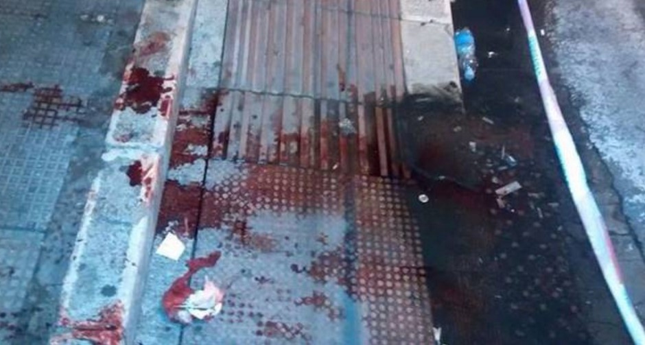 Sangue a Napoli: 22enne accoltellato si trascina in ospedale, è in coma