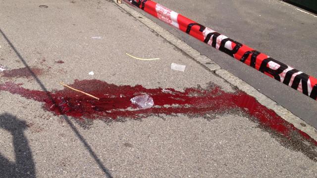 Uomo aggredito da baby gang, finisce in ospedale per i colpi subiti