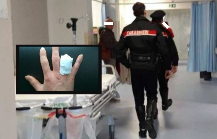 Dita amputate e frattura allo zigomo, sgamata la farsa per truffare l'assicurazione