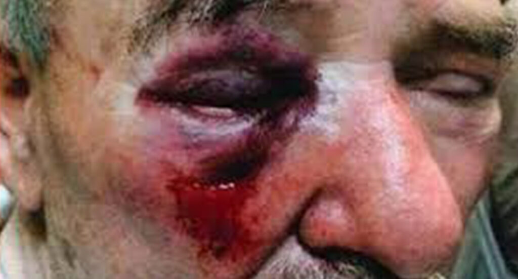 Usuraio aggredisce e picchia un anziano: arrestato dai Carabinieri