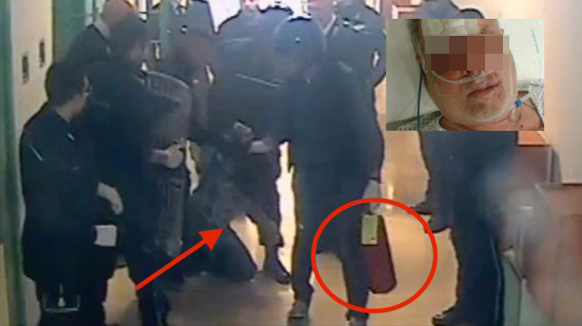 Choc a Napoli, detenuto pestato al Cardarelli: scatta la denuncia