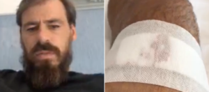 Agguato a Mergellina