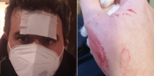 Docente aggredito a Casavatore