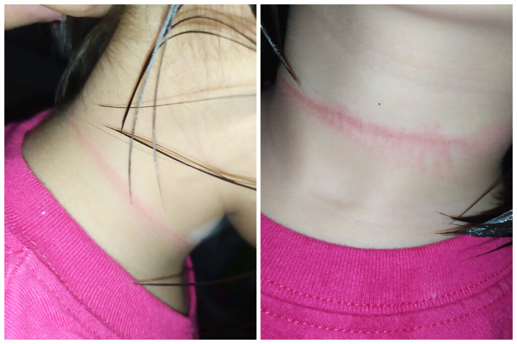 Bambina di 4 anni rischia di morire dopo aver visto un video su TikTok