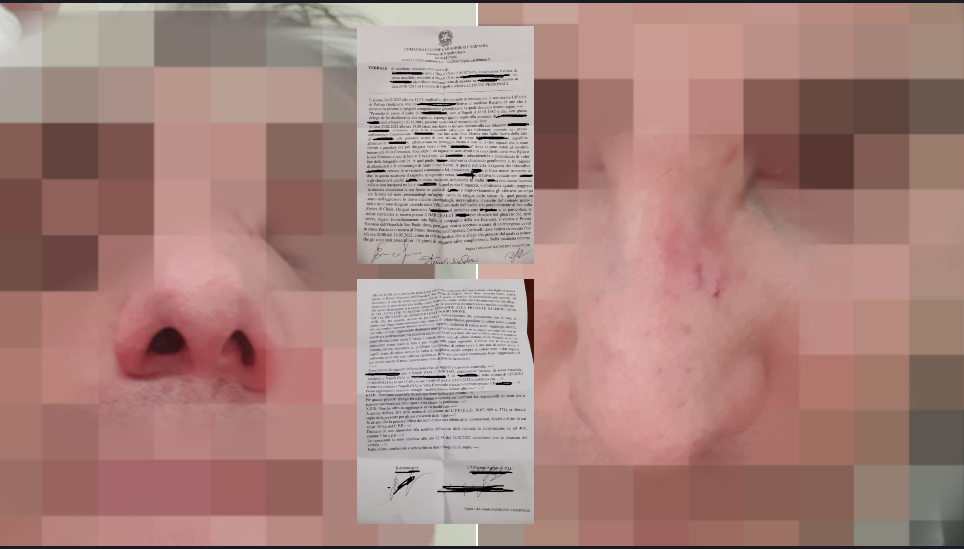 Preso a testate in Villa Comunale