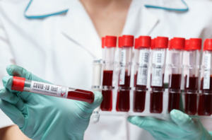 Coronavirus in Campania, sono 3.019 i casi positivi delle ultime 24 ore