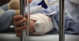 Bimba di 6 anni ruba dolci in un negozio, la mamma le dà fuoco alle mani per punizione