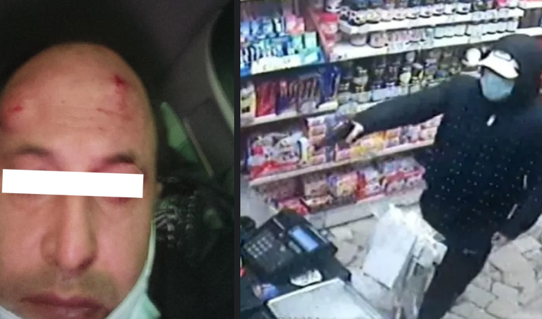 Rapina negozio e colpisce commerciante con pistola, il fratello: "Massacrato per 200 euro"