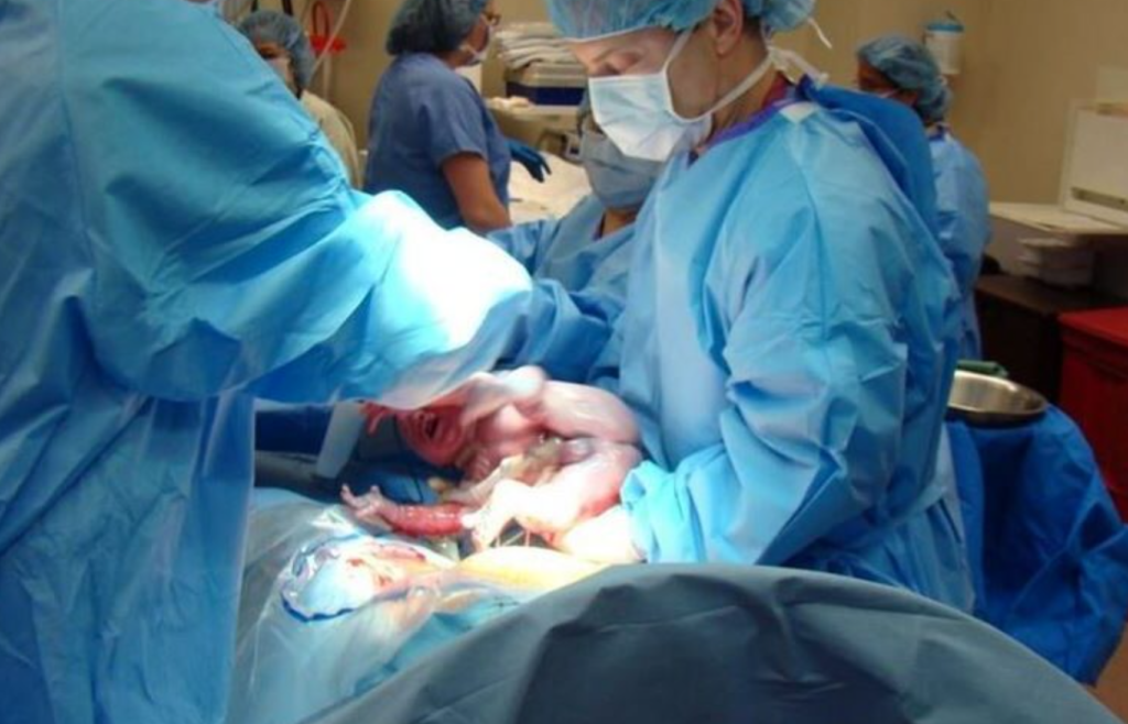 Napoli, incinta non si vaccina, contagiata dal Covid: partorisce, gravi lei e il bambino