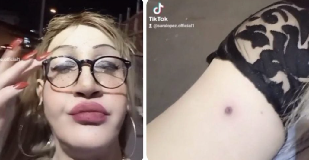 Sara Lopez transgender aggredita pompei pistola