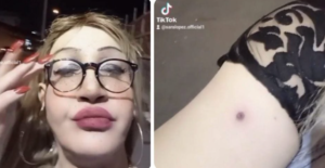 Sara Lopez transgender aggredita pompei pistola