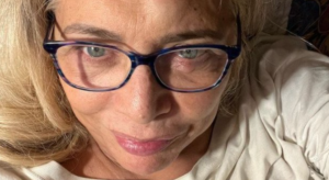 infortunio Mara Venier