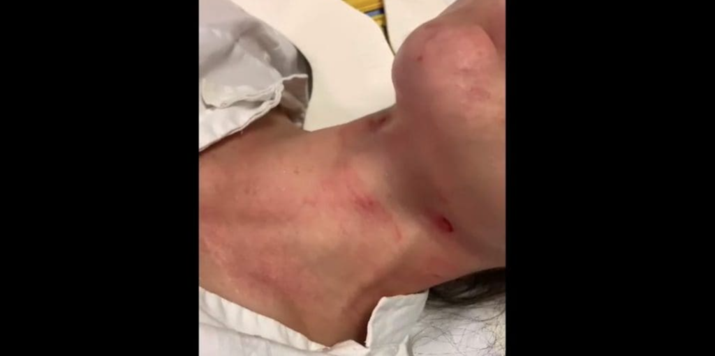 violenza napoli donna