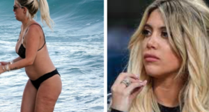 Wanda Nara cellulite