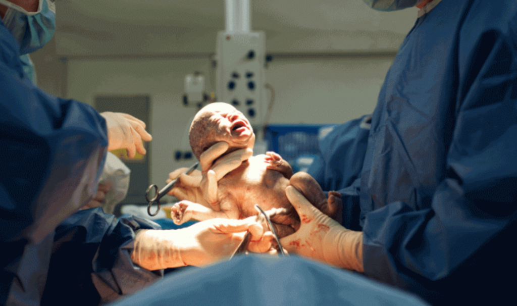 partorisce maschio ma è femmina