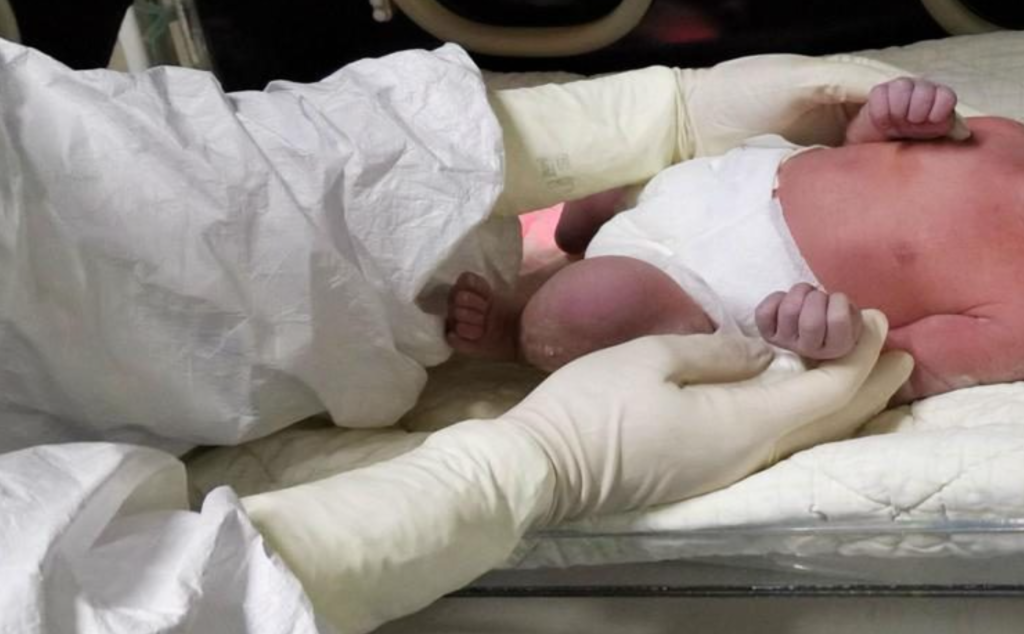 il bambino ha un arresto cardiaco alla nascita